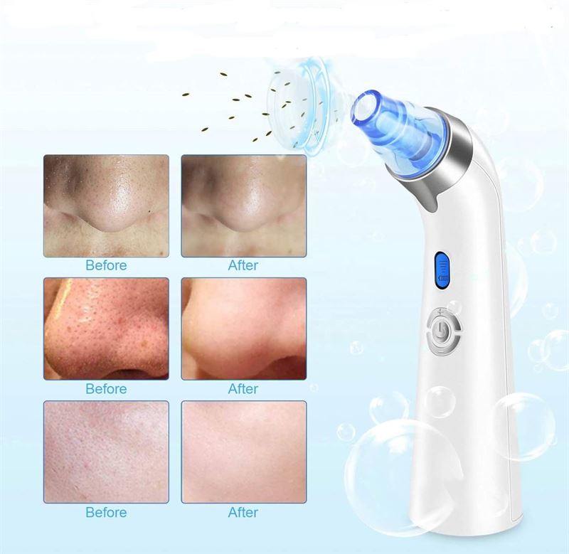 UNIQ Pro Blackhead Remover, Rechargeable Blackhead Remover with LED display - U200 - | Fashiongirl